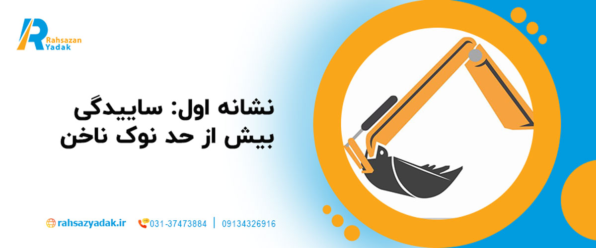 نشانه اول: ساییدگی بیش از حد نوک ناخن