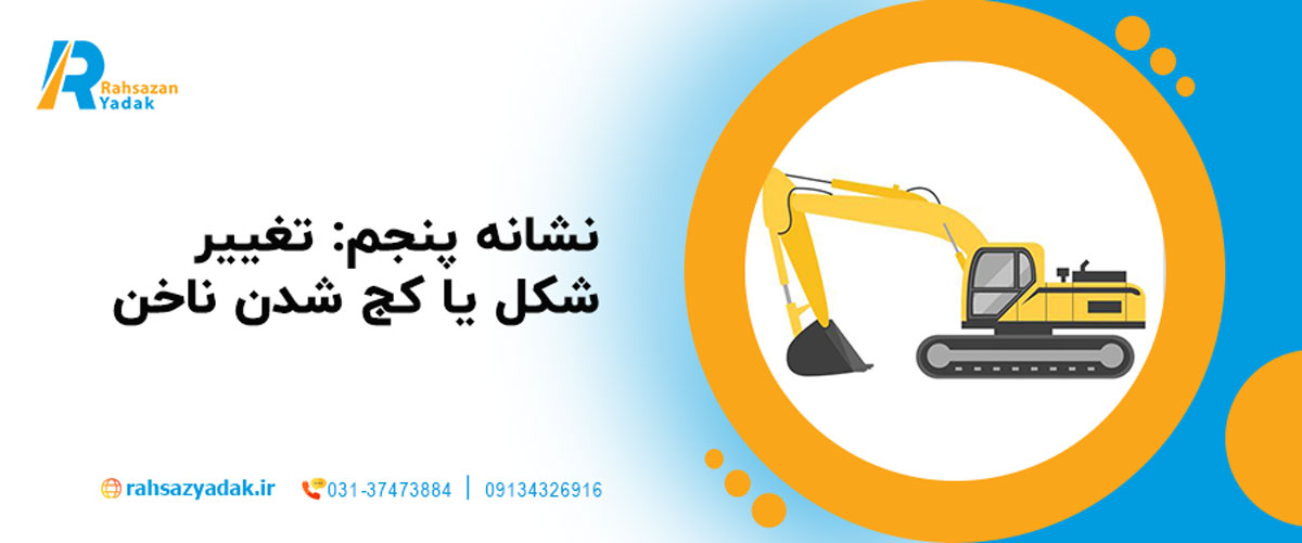 نشانه پنجم: تغییر شکل یا کج شدن ناخن